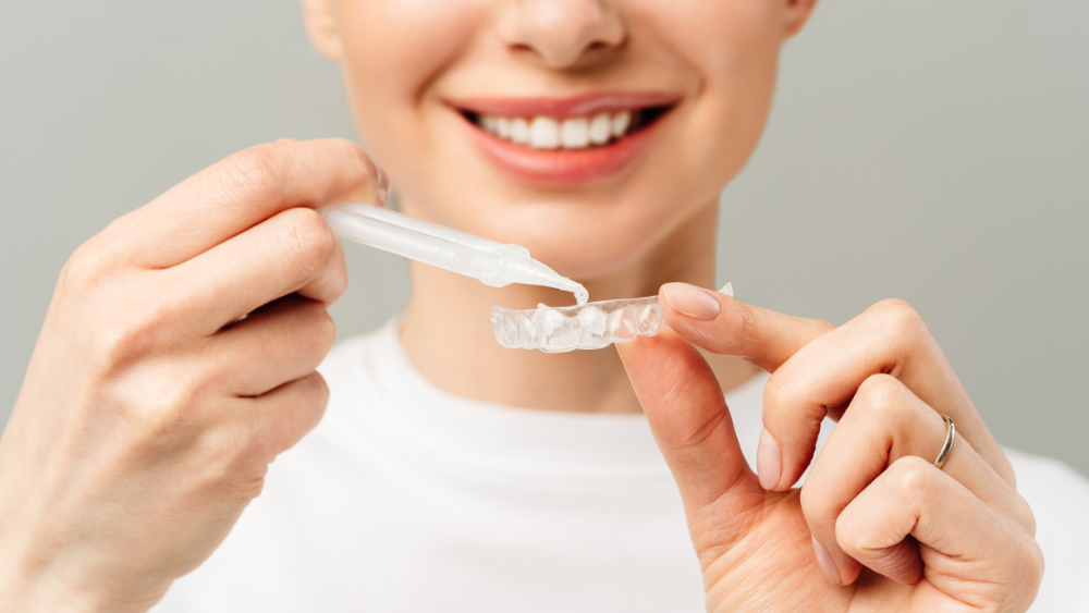 At Home Teeth Whitening
